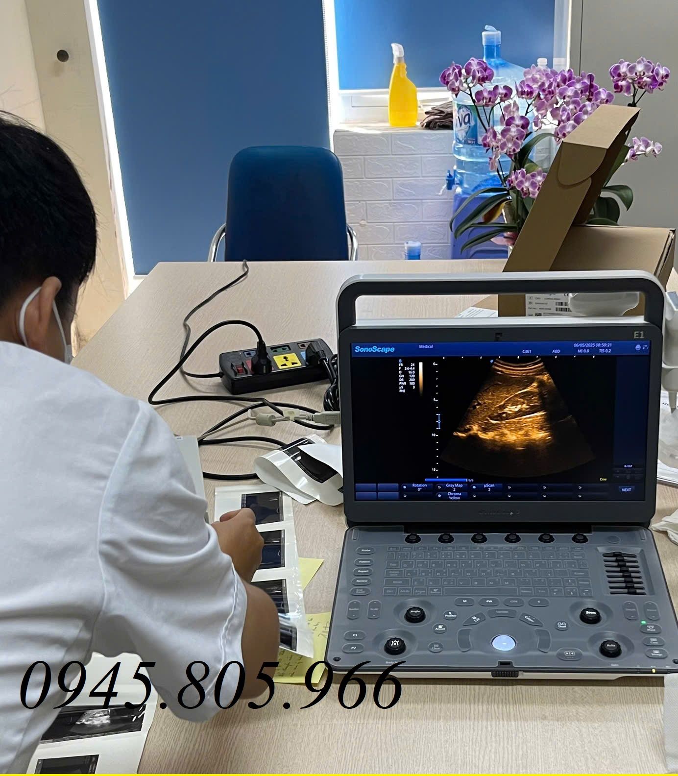 Top 7 máy siêu âm xách tay chất lượng - giá dưới 100 triệu Tại Y Tế Hoàn Mỹ